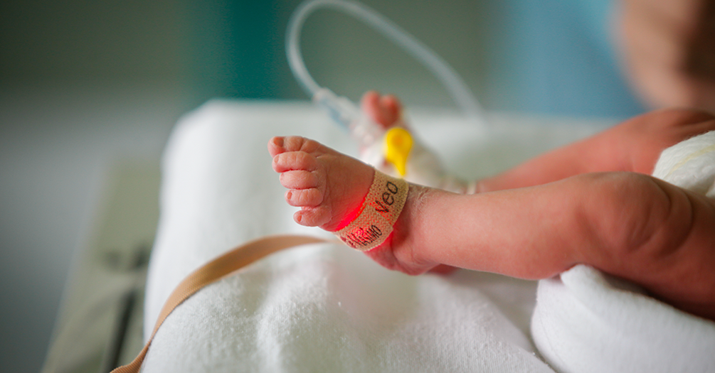 Closeup of a baby's legs and feet in a hospital.